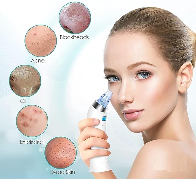 4 In 1 Multi-Function Blackhead Whitehead Remover Device Facial Cleansing Tool ,Skin Cleaner,Pimple Removal Tool,For Men & Women(White)